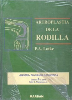 Artroplastia De La Rodilla