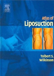 Atlas Of Liposuction