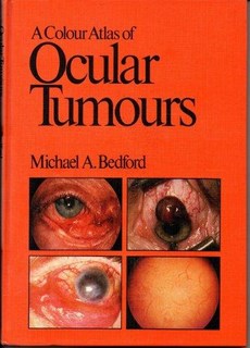 A Color Atlas Ocular Tumours