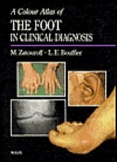 A Color The Foot In Clinical Diagnosis