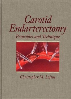 Carotid Endarterectomy