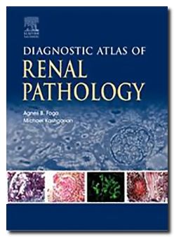 Diagnostic Atlas Of Renal Pathology