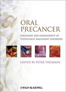 Oral Precancer. Diagnosis And Management Of Potentially Malignant