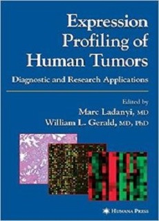 Expression Profiling Of Human Tumors