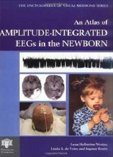 An Atlas Of Amplitude -Integrated Eegs In The Newborn