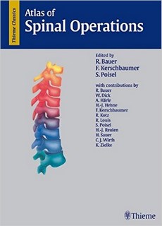 Atlas Of Spinal Operations