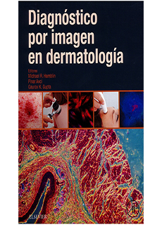 Diagnostico Por Imagen En Dermatologia