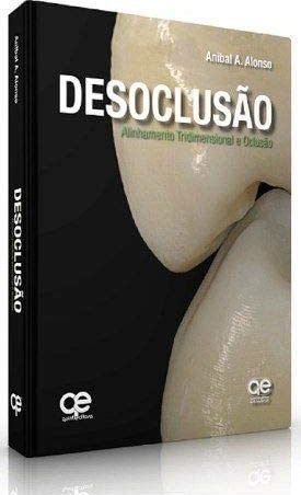 Desoclusión: alineación y oclusión tridimensional (Idioma Portugues)